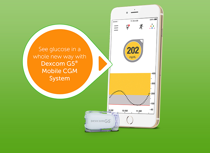 Dexcom